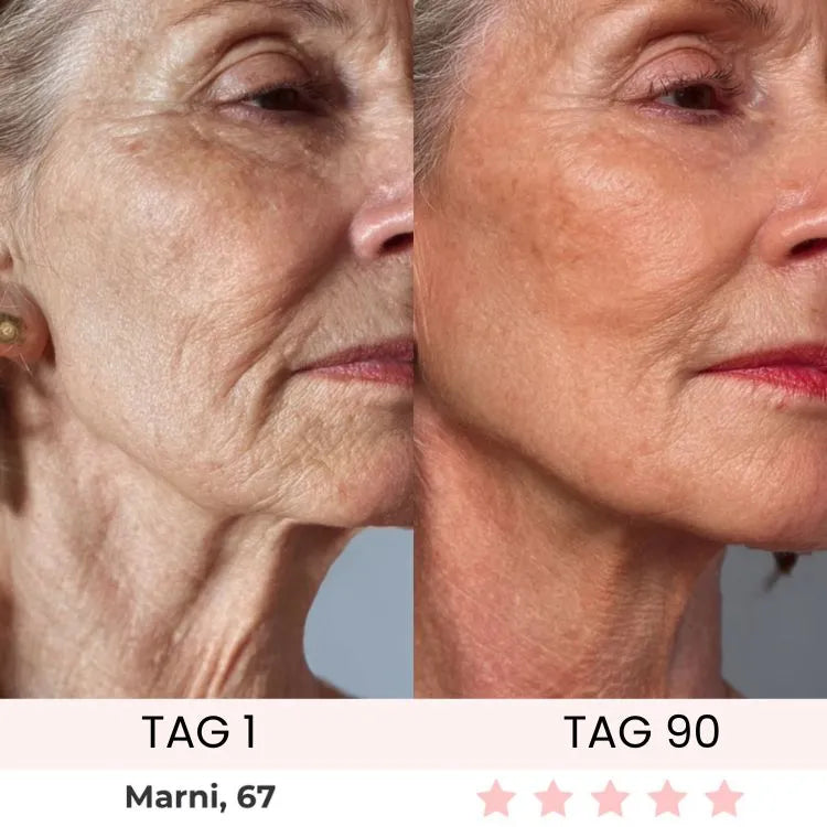 Skinvest 7-LED Facial & Neck Device