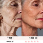 Skinvest 7-LED Facial & Neck Device