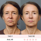 Skinvest 7-LED Facial & Neck Device