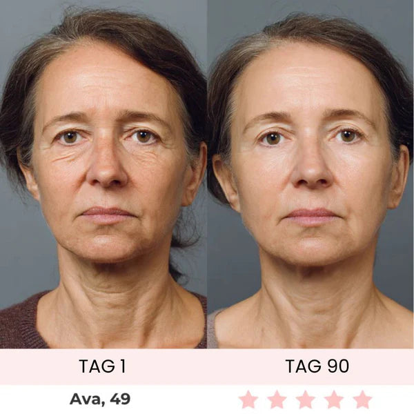 Skinvest 7-LED Facial & Neck Device