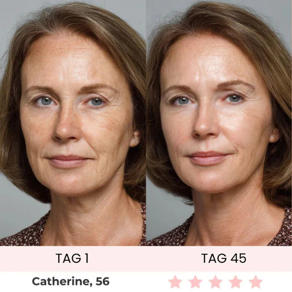 Skinvest 7-LED Facial & Neck Device