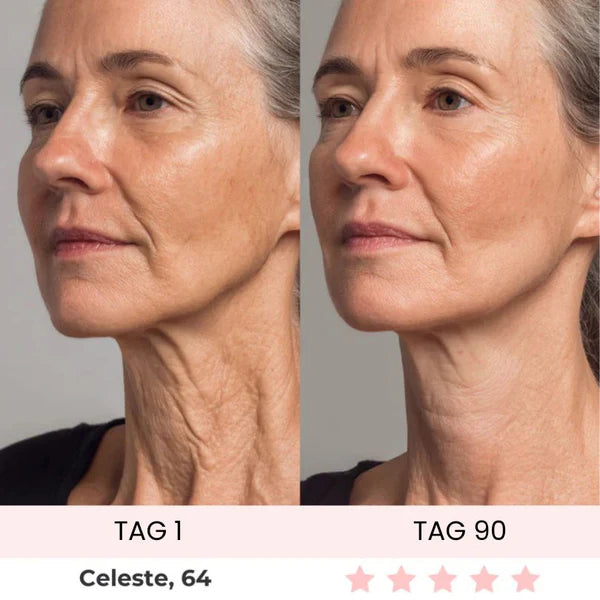 Skinvest 7-LED Facial & Neck Device