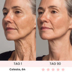 Skinvest 7-LED Facial & Neck Device
