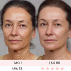 Skinvest 7-LED Facial & Neck Device