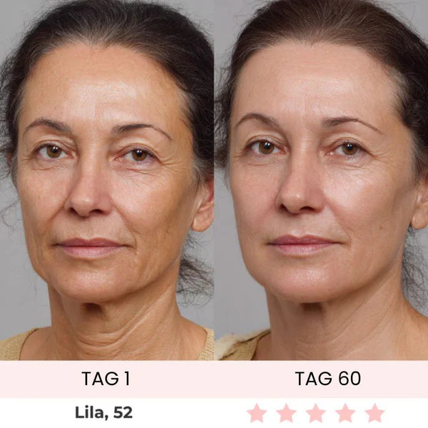 Skinvest 7-LED Facial & Neck Device