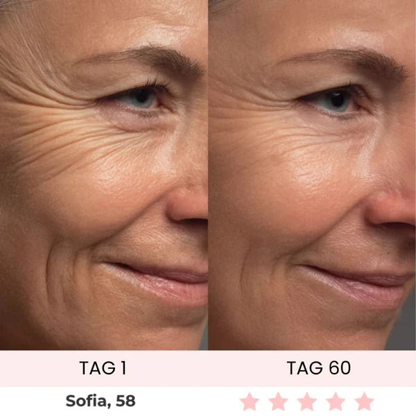 Skinvest 7-LED Facial & Neck Device