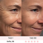 Skinvest 7-LED Facial & Neck Device