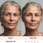 Skinvest 7-LED Facial & Neck Device